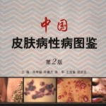中国皮肤病性病图鉴(第二版)
