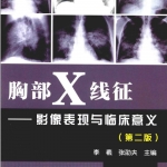 胸部X线征——影像表现与临床意义 第2版